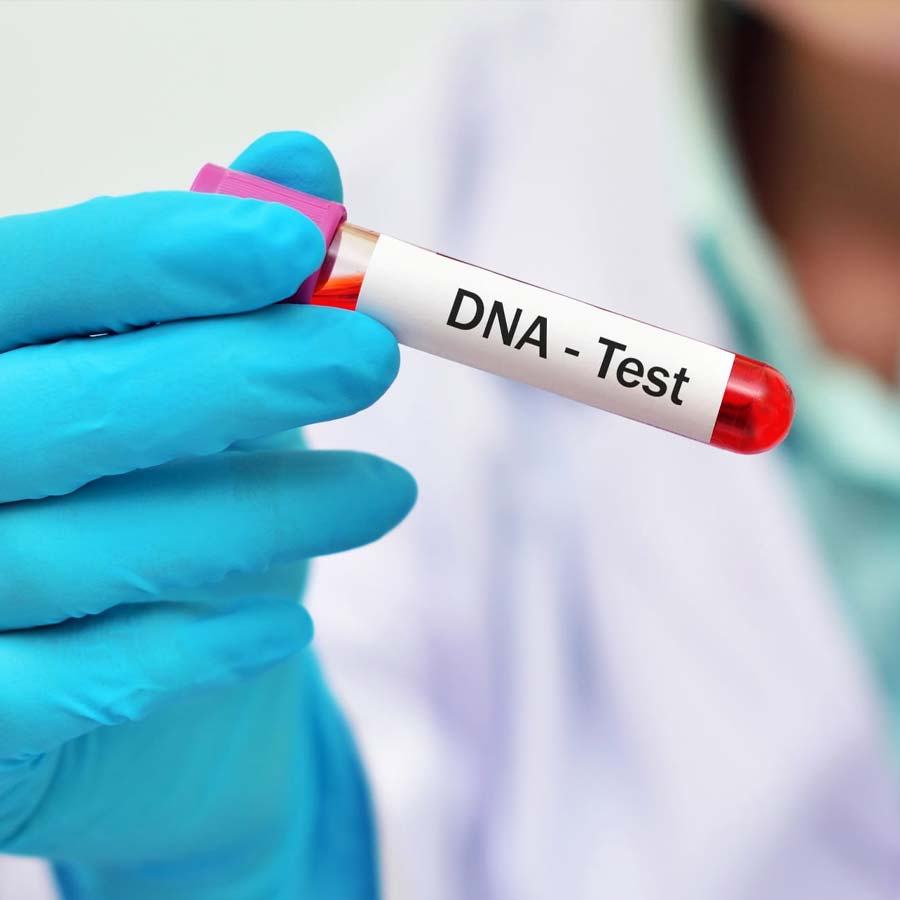 Laborprobe Fuer Dna Untersuchung Foto F381